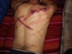 Hrvatska policija greškom pretukla migranta: Mislili da je Srbin!